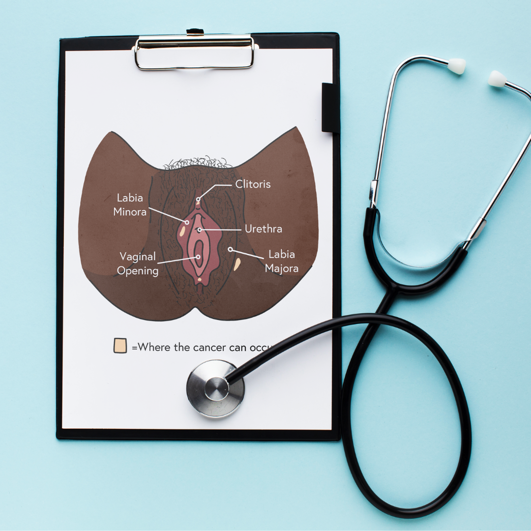 MEDICAL & PRODUCT DIAGRAMS
Illustrated product & anatomical diagrams—Accurate & inclusive